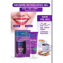 Begisun Diş Beyazlatma Jeli 50 ml – V34 & 4d  Teknolojili, Sarı Ton Giderici, Hızlı Parlaklık