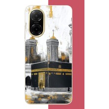 Aksesuarist Redmi A5 Uyumlu Kabe6 Baskılı Silikon Kılıf