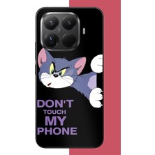 Aksesuarist Xiaomi Mi 15T Pro Uyumlu Telefonuma Dokunma2 Baskılı Silikon Kılıf