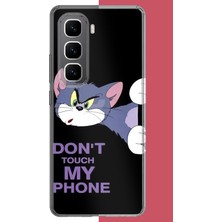 Aksesuarist Infinix Gt 50 Pro Uyumlu Telefonuma Dokunma2 Baskılı Silikon Kılıf
