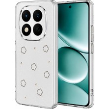 Aslanoğlu Store Xiaomi Redmi Note 15 4g Fiyonk Desenli Kapak - Desen 2