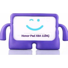 Marmara Avm Honor Pad X8B X8A 11INÇ Uyumlu Çocuklar Için Silikon Tablet Kılıfı