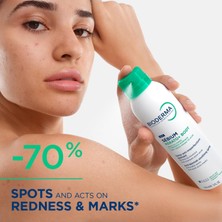 Lexroo Sebium Kerato+ Body Sivilce ve Akne Lekesi Karşıtı Ferahlatıcı Vücut Spreyi 150 ml