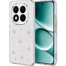 Str Store Xiaomi Redmi Note 15 Pro Plus 5g Fiyonk Desenli Kapak - Desen 3