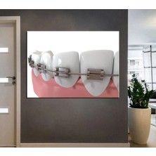 Şehzat Design Ağız ve Diş Sağlığı Polikliniği Tabloları Dekoratif Diş, Dekoratif Dişçi, Dişçi Dekorasyonu
