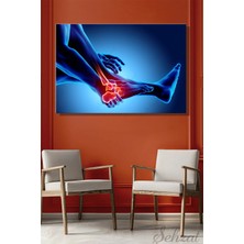 Şehzat Design Yatay Tekli Kanvas Duvar Tablosu Modern Klinik Hastane Doktor Röntgen Film Ayak Bilek Ağrı 3D Iş