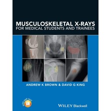 Fumeyabi Musculoskeletal X-Rays For Medical Students And Trainees