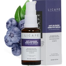 Str Store Leke Karşıtı ve Cilt Tonu Dengeleyici Serum –%2 Arbutin Içerikli, Aydınlatıcı ve Eşitleyici Etkili Yüz Serumu – Hiperpigmentasyon ve Renk Eşitsizliği Için – 30 ml