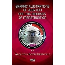 Str Store Graphic Illustrations Of Abortion And The Diseases Of Menstruation