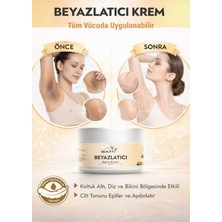 Miya Beauty En Iyi Cilt Tonu. Eşitleyici Koltuk Genital Bölge Yüz-Altı-Diz-Dirsek Leke Giderici Ve Beyazlatıcı Krem 100 ml