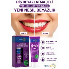Begisun Diş Beyazlatma Jeli 50 ml – V34 & 4d  Teknolojili, Sarı Ton Giderici, Hızlı Parlaklık