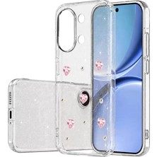 SBN - Store Xiaomi Poco X8 Pro Max Fiyonk Desenli Kapak - Desen 3