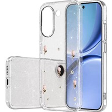 SBN - Store Xiaomi Poco X8 Pro Fiyonk Desenli Kapak - Desen 6