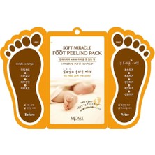 SBN - Store Prime Mjcare Miracle Çorap Tipi Ayak Peeling Maskesi