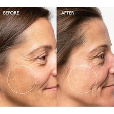 SBN - Store Prime Beyazlatıcı Etkili Leke Karşıtı Bakım Kremi Arbutin Yüzde Iki Brightening Krem 50ML (2 Paketi)