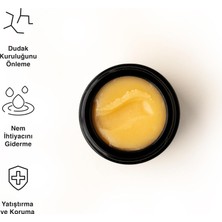 Str Store Lip Treat Dudak Balmı 10 ml