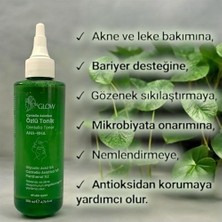 SBN - Store Miglow Centella Asiatica Özlü Canlandırıcı Leke-Gözenek-Akne Karşıtı Tonik