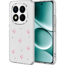 Mabelme Store Xiaomi Redmi Note 15 Pro 5g Fiyonk Desenli Kapak - Desen 3
