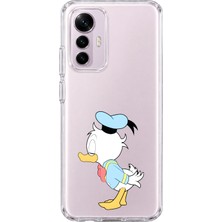 Mobilpad Xiaomi Mi 12 Lite Uyumlu Sevimli Ördek Desenli Şeffaf Telefon Kılıfı