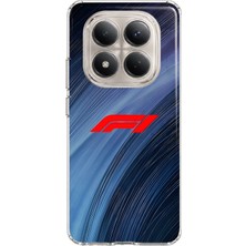 Mobilpad Redmi Note 15 Pro 5g Uyumlu Formula Desenli Şeffaf Telefon Kılıfı
