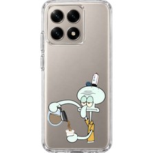 Mobilpad Xiaomi 15T Uyumlu Squidward Desenli Şeffaf Telefon Kılıfı