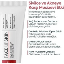 Akne Kremi Yüz Için – Sivilce ve Akne Karşıtı Leke Kremi – Salisilik Asit & Niasinamid ile Leke Giderici – Genç ve Yetişkin Cilt Bakımı, 40 ml