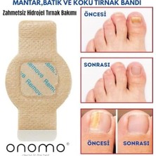 Prime Tırnak Mantarı Bandı, Hidrojel Tırnak Bakımı 5 Adet