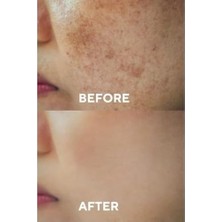 Çelik Ticaret The Ceel Leke Karşıtı ve Cilt Tonu Eşitleyen Cilt Serumu, Glutatyon & Niacinamide Etkili 30 ml