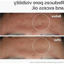 Die Grup 30 ml Niacinamide ve Çinko Içeren Cilt Bakım Ürünü