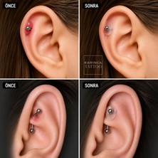Aydogan's Piercing Keloid Diski Bump Piercing Yara Önleyici Bioplast (10 Adet)