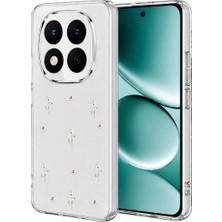 Xiaomi Redmi Note 15 Pro Plus 5g Fiyonk Desenli Kapak - Desen 4