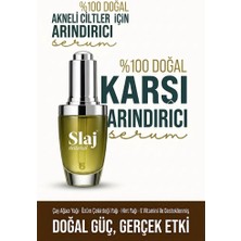 Slaj Akneli Ciltler Için Arındırıcı Yüz Serumu - %100 Doğal – Sivilce ve Gözenek Karşıtı Bakım (30 Ml)