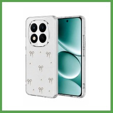 Bezos Redmi Note 15 Pro Plus 5g Uyumlu Fiyonk Desenli Kapak - Desen 5 Mgc