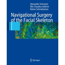 Springer Navigational Surgery Of The Facial Skeleton