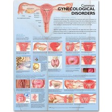 MUJGAN Common Gynecological Disorders Anatomical Chart