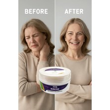 MiraLive Fıtık Kurutan Krem 50 ml