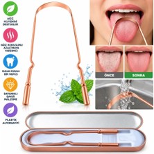 NW NessiWorld If Bakır Oil Pulling Yağ Çekme Dil Plak Temizleme Aleti Dil Fırçası Sıyırıcı Dil Kaşığı (Adet Fiyatıdır)