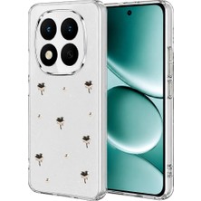 Uravas Store Uraselect Xiaomi Redmi Note 15 Pro Plus 5g Fiyonk Desenli Kapak - Desen 1