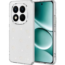 Uravas Store Uraselect Xiaomi Redmi Note 15 Pro 5g Fiyonk Desenli Kapak - Desen 10