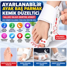 Marka Kolik Ayarlanabilir Ayak Baş Parmak Kemik Düzeltici – Halluks Valgus (Bunyon) Aparatı, Gece Gündüz Kullanıma Uygun Ayak Düzeltme Ateli