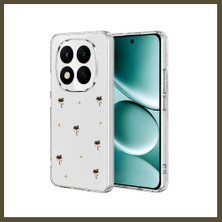 Northcity Redmi Note 15 4g Uyumlu Fiyonk Desenli Kapak - Desen 1 Bx