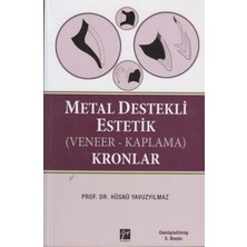 Gazi Kitabevi Metal Destekli Estetik (Veneer-Kaplama)Kronlar