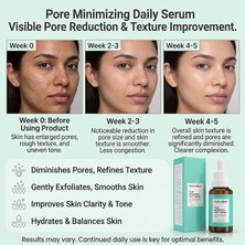 Salisilik Asit%2 & Niacinamide%5 Gözenek Görünümü Inceltici Cilt Serumu – Yağ Dengesi ve Pürüzsüzlük Destekleyici Yüz Serumu, 30 ml