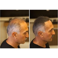 MSP Şişe 28 Gr. Saç Dolgunlaştırıcı Topik (Koyu Kahve)