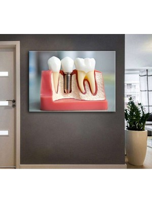 Caddeko Ağız ve Diş Polikliniği, Dişçi Tabloları Dekoratif Diş, Dekoratif Dişçi, Dişçi Dekorasyonu DSC187