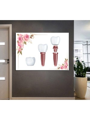 Caddeko Ağız ve Diş Sağlığı Polikliniği Tabloları Dekoratif Diş, Dekoratif Dişçi, Dişçi Dekorasyonu DSC-168