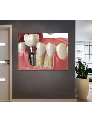 Caddeko Ağız ve Diş Polikliniği, Dişçi Tabloları Dekoratif Diş, Dekoratif Dişçi, Dişçi Dekorasyonu DSC207