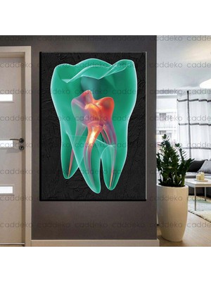 Caddeko Ağız ve Diş Sağlığı Polikliniği Tabloları Dekoratif Diş, Dekoratif Dişçi, Dişçi Dekorasyonu DSC-145