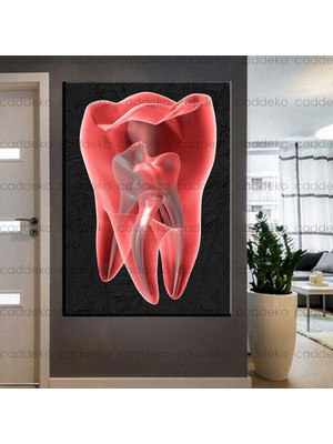 Caddeko Ağız ve Diş Sağlığı Polikliniği Tabloları Dekoratif Diş, Dekoratif Dişçi, Dişçi Dekorasyonu DSC-136
