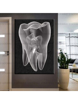 Caddeko Ağız ve Diş Sağlığı Polikliniği Tabloları Dekoratif Diş, Dekoratif Dişçi, Dişçi Dekorasyonu DSC-137